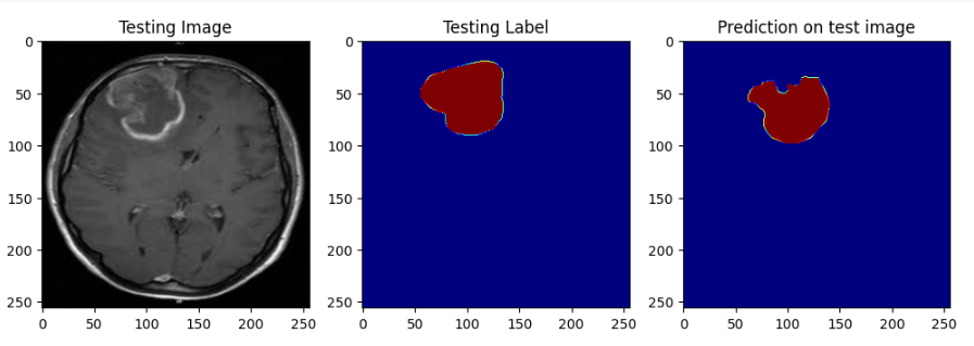 Brain Tumor Detection copy