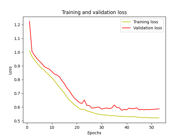 Brain Tumor Detection